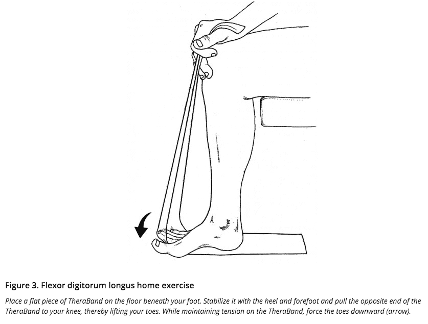 running with plantar fasciitis